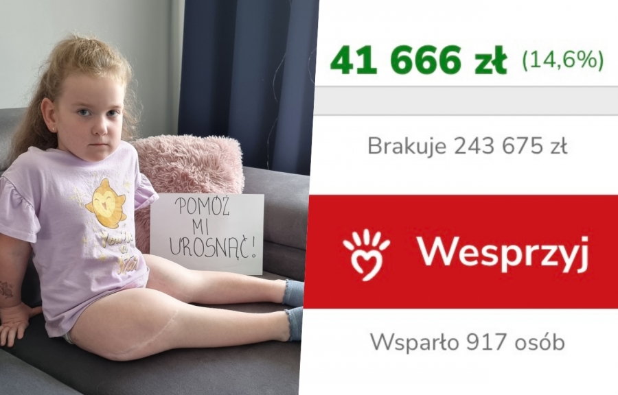 Trwa wyścig z czasem o zdrowie małej Lilianki. Potrzeba ponad 240 tys. zł